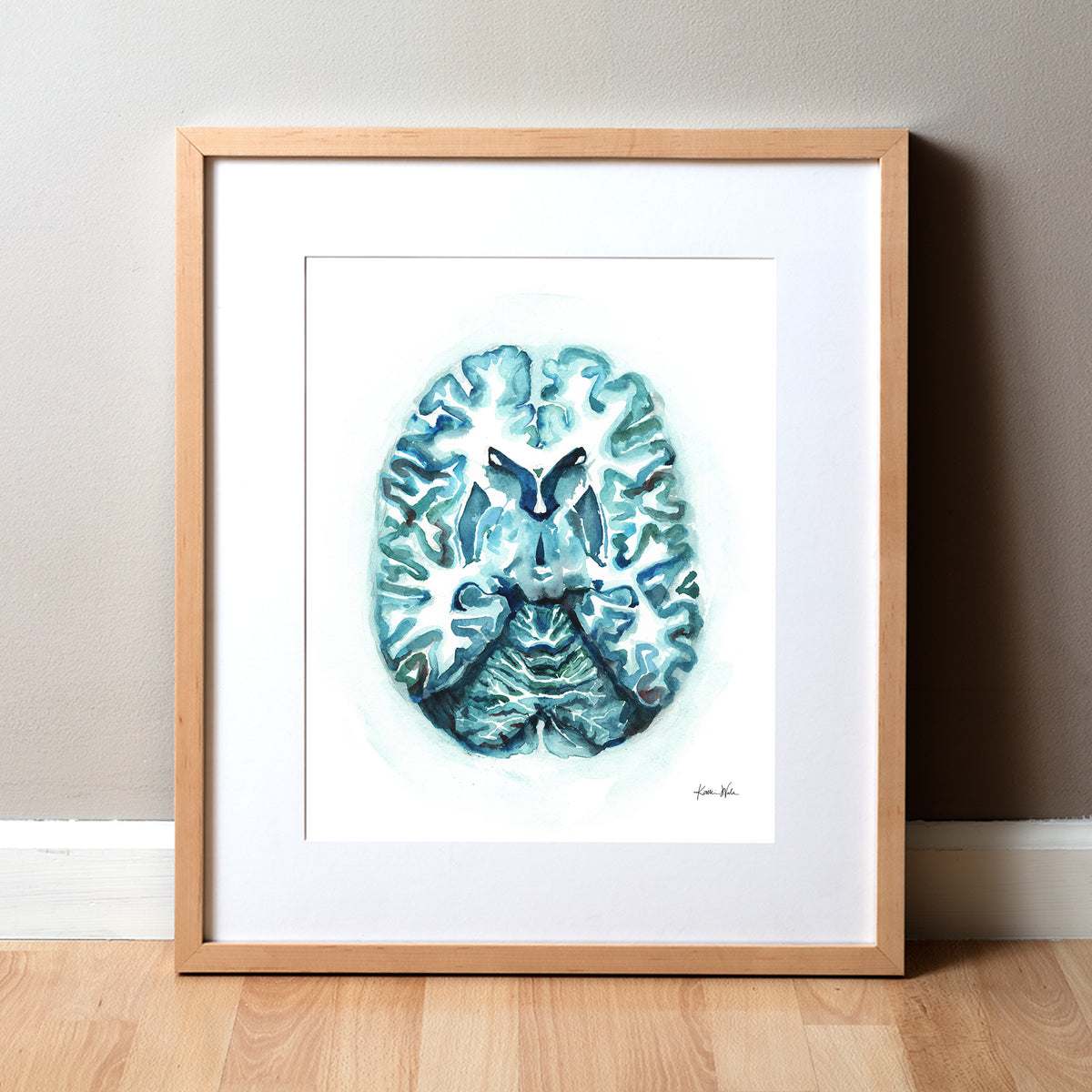 Transverse Brain Watercolor Print – Lyon Road Art