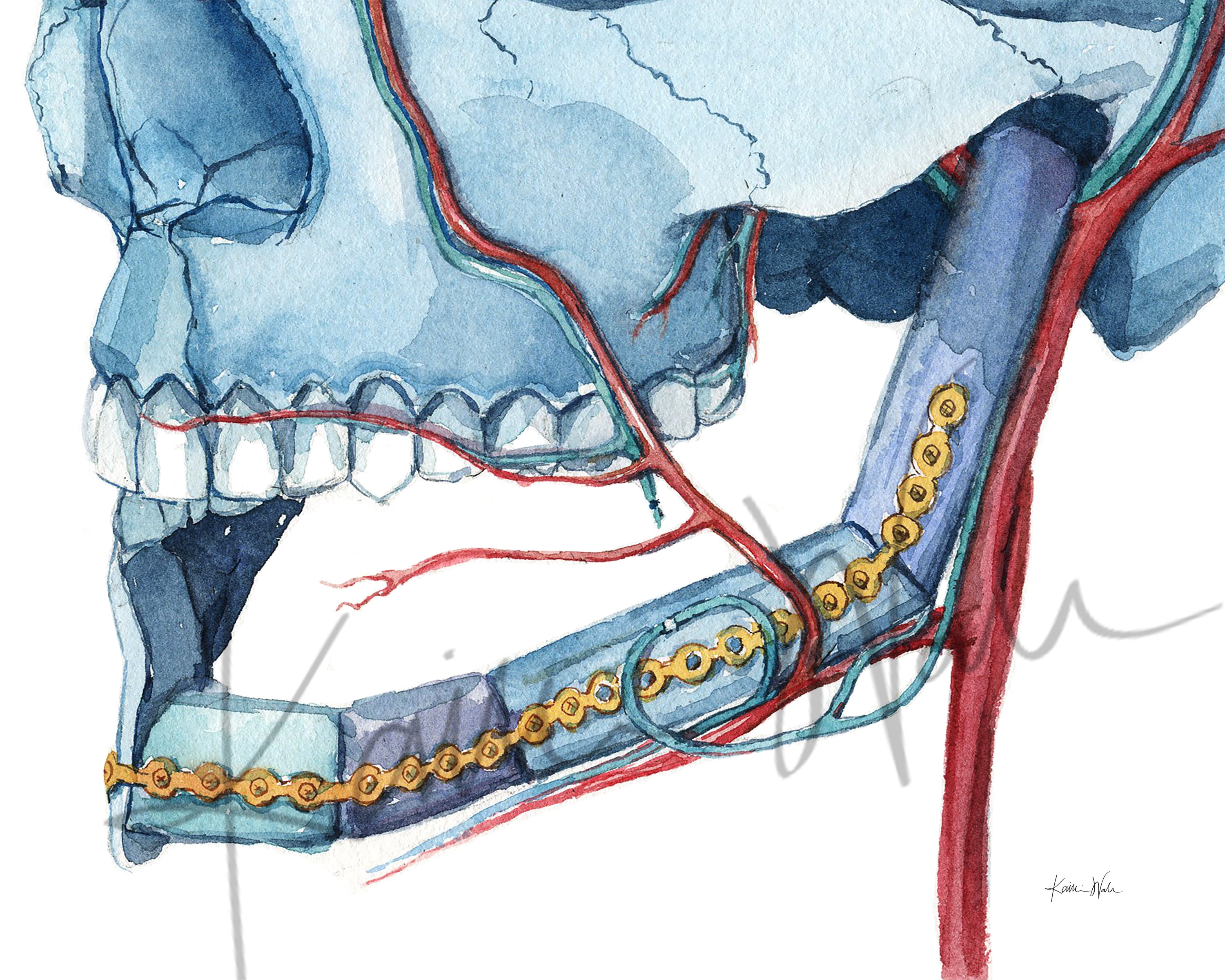 Anastomosis OMFS Watercolor Print