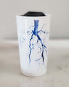 Aorta Angiogram Ceramic Travel Mug