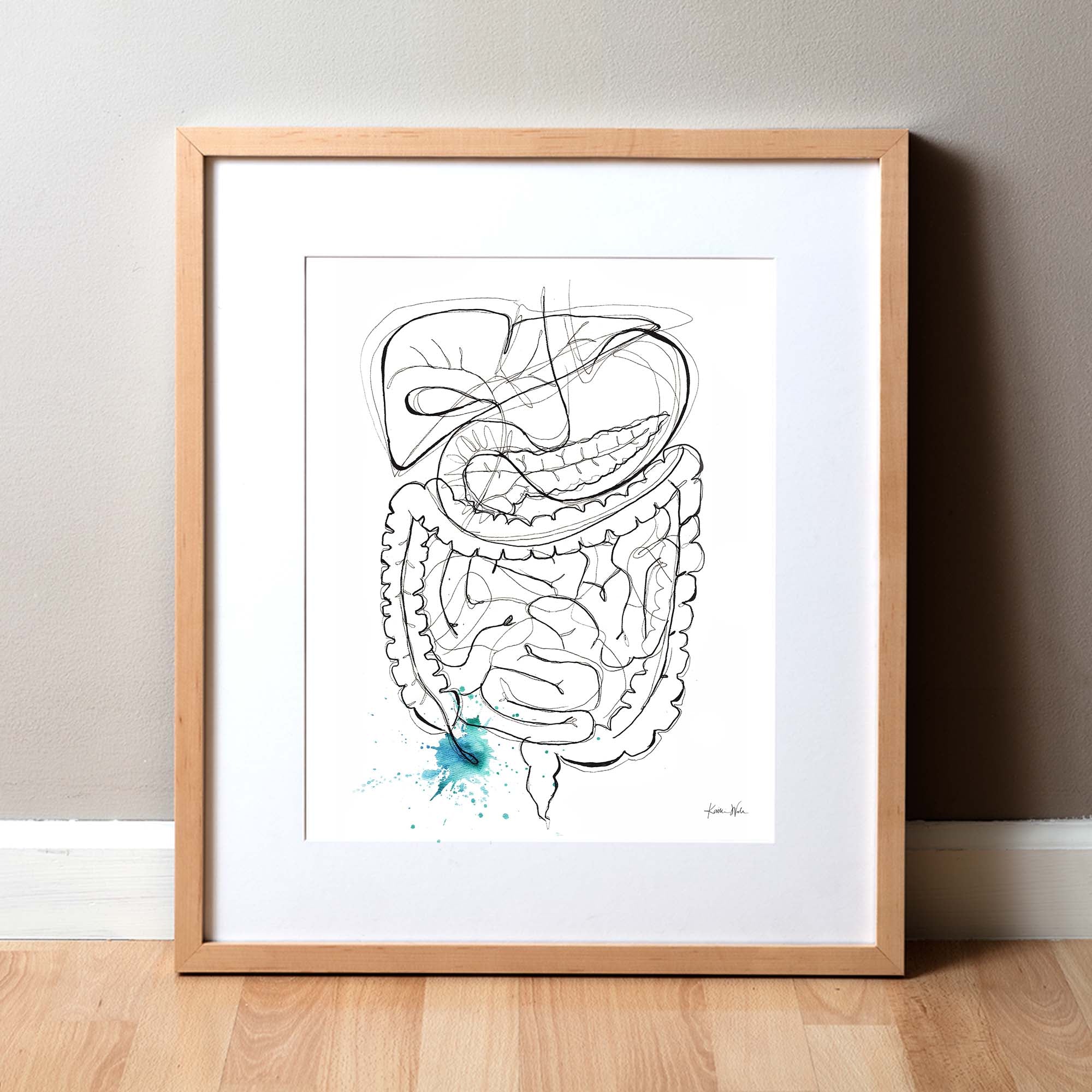 Appendicitis Watercolor Print