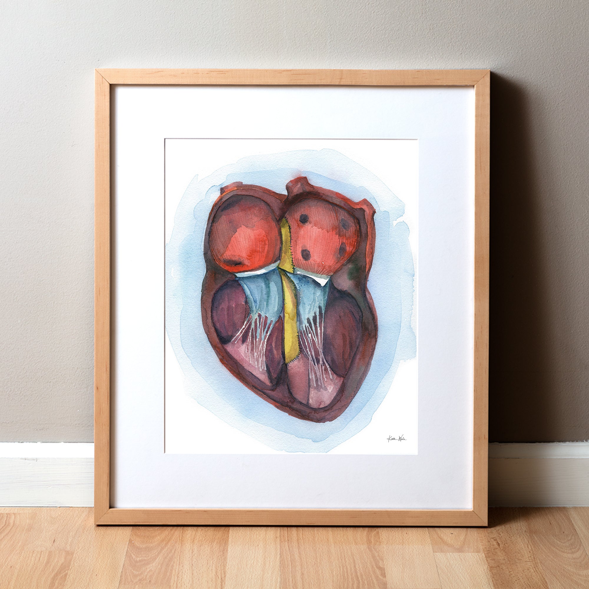 AVSD Heart Watercolor Print