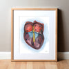 AVSD Heart Watercolor Print