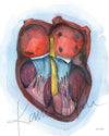 AVSD Heart Watercolor Print