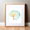 Rainbow Cerebral Angiography Watercolor Print