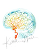 Rainbow Cerebral Angiography Watercolor Print