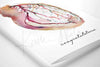 Coronary Angiogram Greeting Card | Congratulations