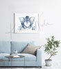 Framed watercolor painting of a hip repair with pinning. The painting is hanging over a blue couch.