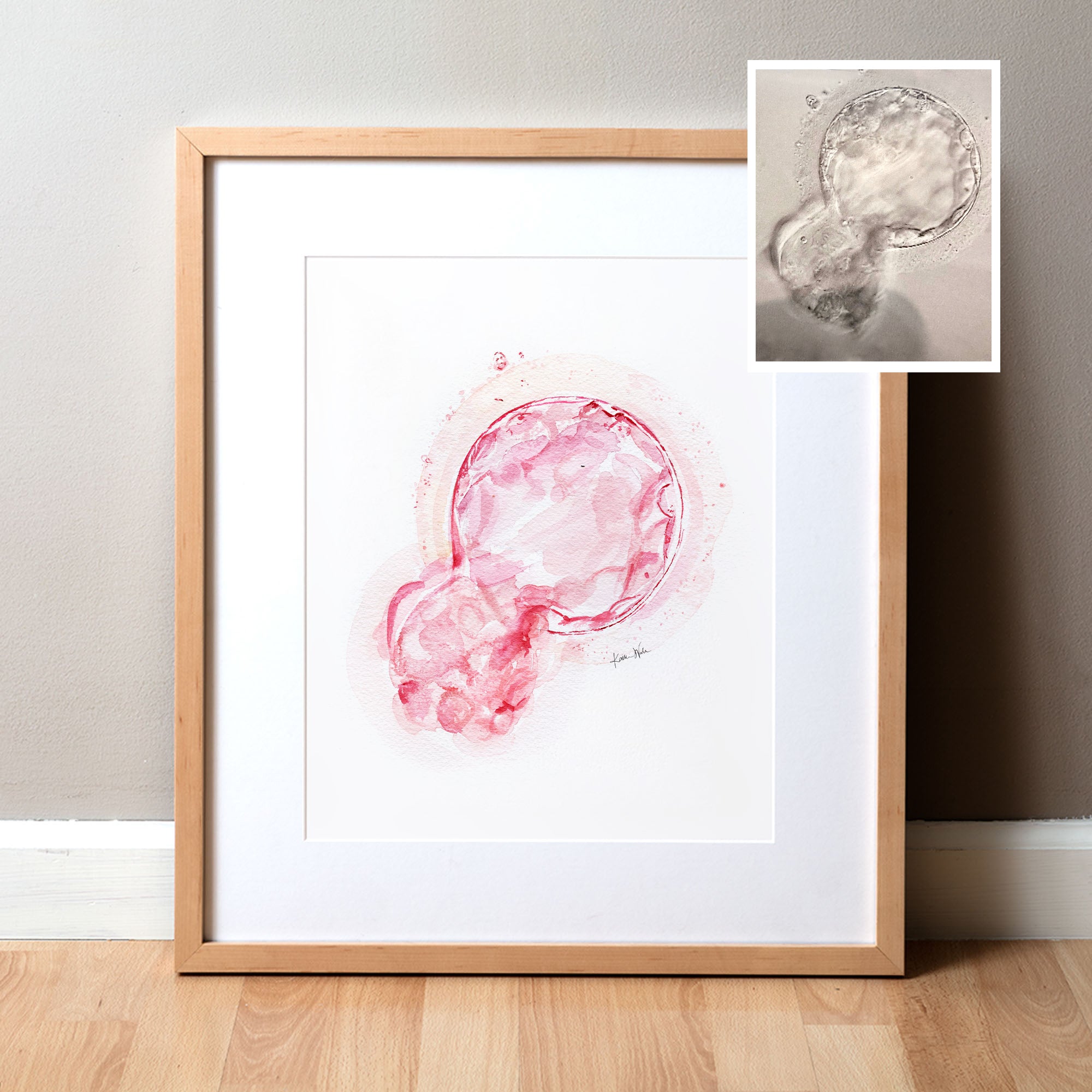 Custom Embryo Watercolor – Lyon Road Art