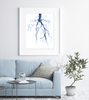 Aorta Angiogram Print Watercolor