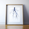 Aorta Angiogram Print Watercolor