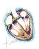 Heart Valve Replacement Watercolor Print