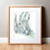 Rheumatoid Arthritis(Ra) Of The Hand Watercolor Print