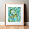 Basal Cell Carcinoma Watercolor Print