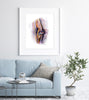 Deep Vein Thrombosis Watercolor Print