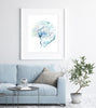 Cerebral Angiography Watercolor Print