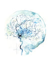 Cerebral Angiography Watercolor Print