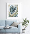 Normal Colonoscopy Watercolor Print