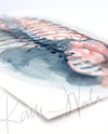 Angled view of a watercolor painting of a diaphragmatic hernia.