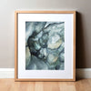 Crohns Disease Colonoscopy Watercolor Print