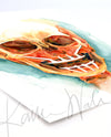 Unframed watercolor painting at an angle of a mandibular and maxillary all on 4 with two anterior implants and 2 zygomatic implants.