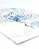 Cerebral Angiography Watercolor Print