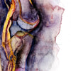 Deep Vein Thrombosis Watercolor Print