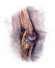 Deep Vein Thrombosis Watercolor Print