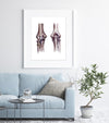 Elbow Joint Anatomy Print Watercolor