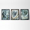 Normal Crohns And Ulcerative-Colitis Colonoscopy Watercolor Print Set