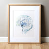 Cerebral Angiography Watercolor Print