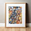 Spinal Muscular Atrophy (Sma) Watercolor Print