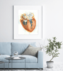 Hypertrophic Cardiomyopathy Heart Watercolor Print