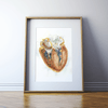 Hypertrophic Cardiomyopathy Heart Watercolor Print