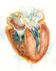 Hypertrophic Cardiomyopathy Heart Watercolor Print