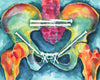 Bright Pelvis Watercolor Print - Orthopedic Art