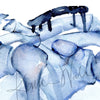 Zoomed in view of a watercolor painting of a before and after of shoulder/clavicle surgery.