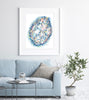 Islet Of Langerhans Watercolor Print - Endocrine Art Diabetes Gift For Endocrinologist