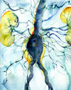 Anatomical Watercolor Print of Arteriogram 