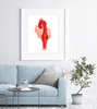 Thoracic Aneurysm Print Watercolor