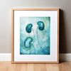 Kidney Transplant Print Watercolor