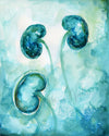 Kidney Transplant Print Watercolor