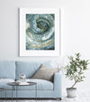 Ulcerative-Colitis Colonoscopy Watercolor Print