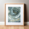 Ulcerative-Colitis Colonoscopy Watercolor Print