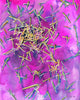 Uric Acid Crystals Watercolor Print